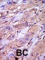 CSNK1E Antibody (C-term)